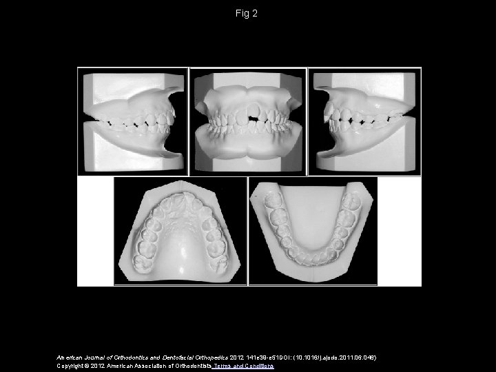 Fig 2 American Journal of Orthodontics and Dentofacial Orthopedics 2012 141 e 39 -e