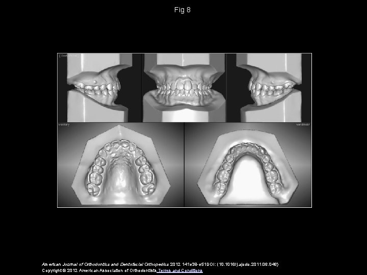 Fig 8 American Journal of Orthodontics and Dentofacial Orthopedics 2012 141 e 39 -e