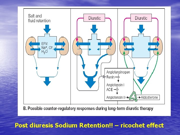 Post diuresis Sodium Retention!! – ricochet effect 