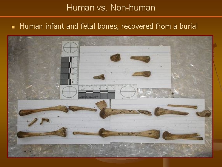 Human vs. Non-human n Human infant and fetal bones, recovered from a burial 