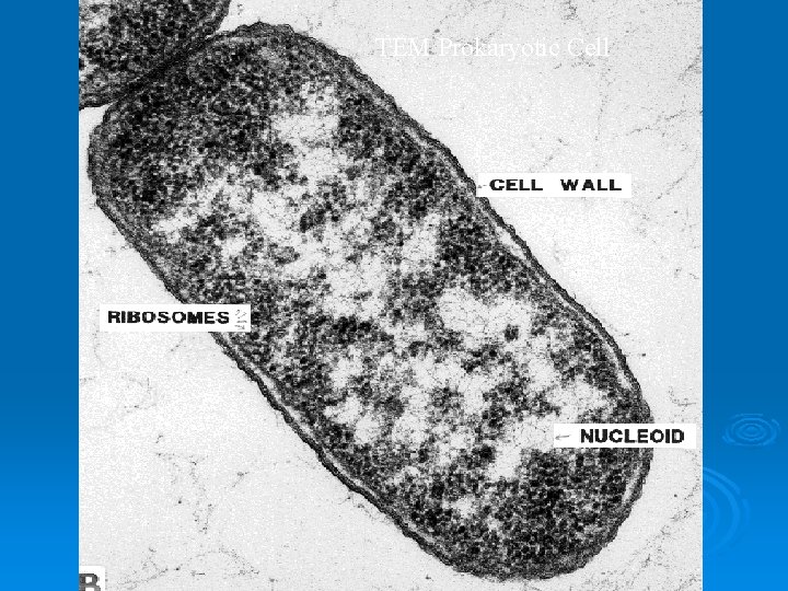 TEM Prokaryotic Cell 