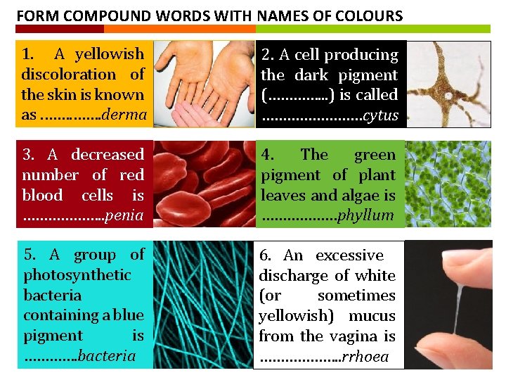 FORM COMPOUND WORDS WITH NAMES OF COLOURS 1. A yellowish discoloration of the skin