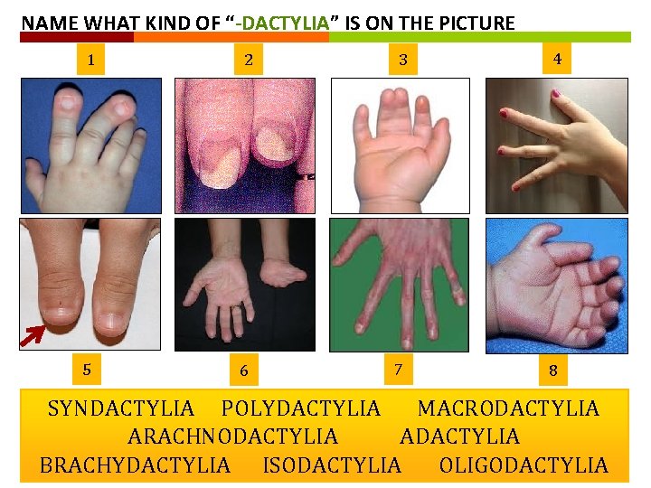 NAME WHAT KIND OF “-DACTYLIA” IS ON THE PICTURE 1 2 3 4 5