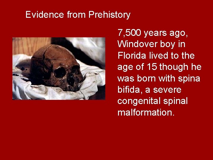 Evidence from Prehistory 7, 500 years ago, Windover boy in Florida lived to the