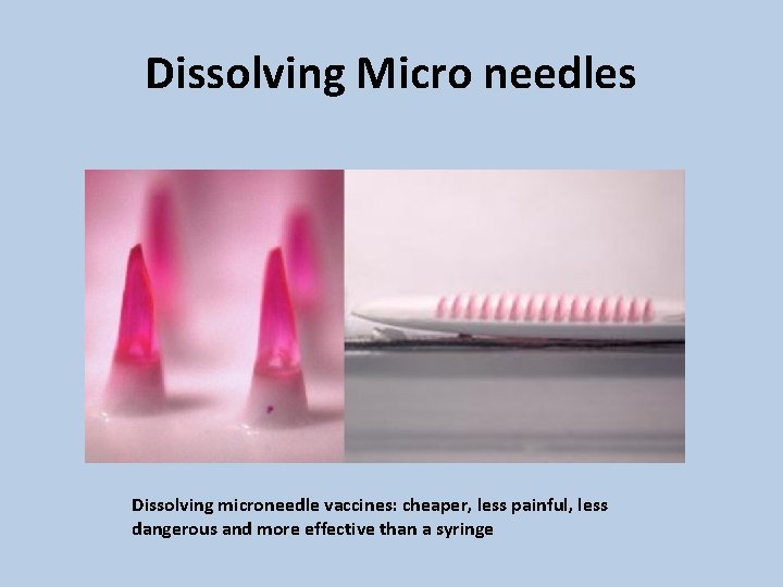 Dissolving Micro needles Dissolving microneedle vaccines: cheaper, less painful, less dangerous and more effective