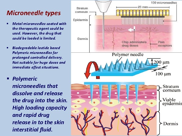 Microneedle types § Metal microneedles coated with therapeutic agent could be used. However, the