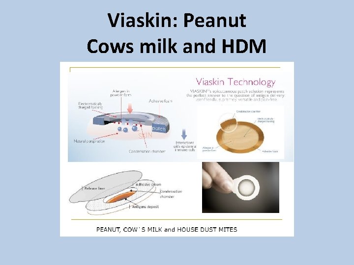 Viaskin: Peanut Cows milk and HDM 