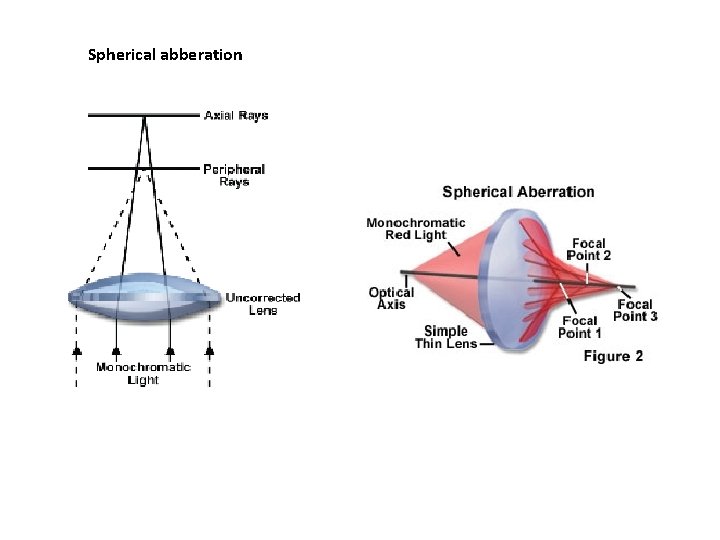 Spherical abberation 