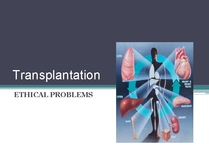 Transplantation ETHICAL PROBLEMS 