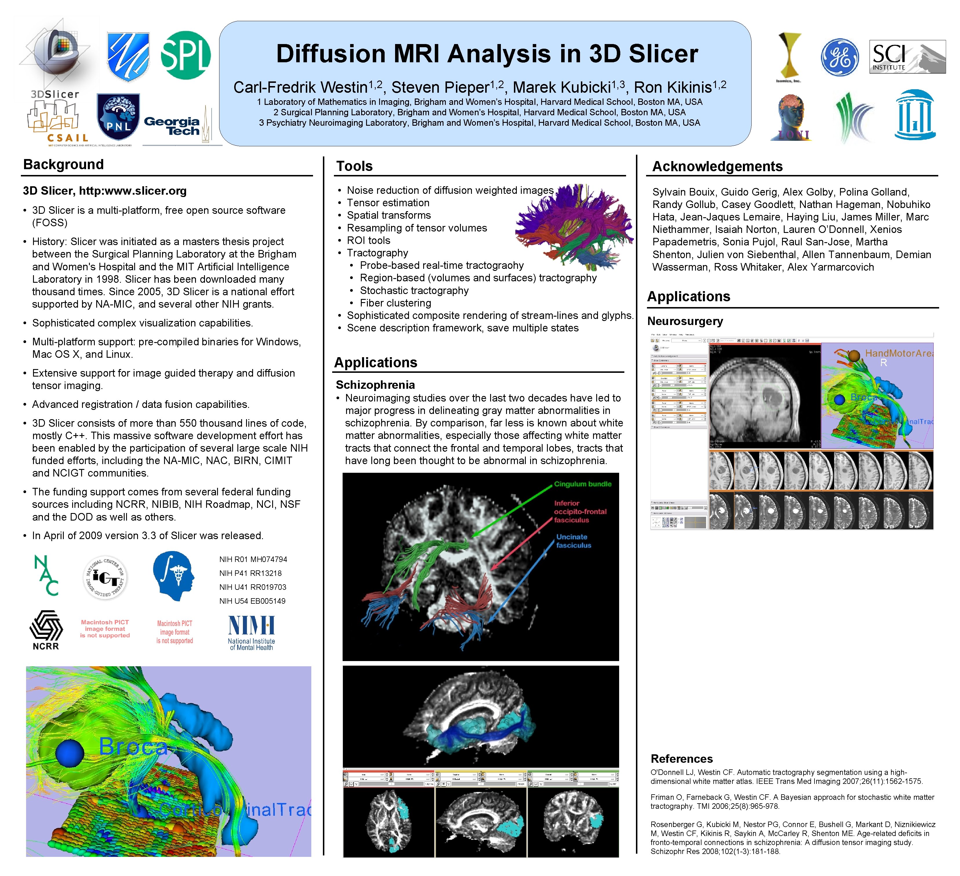 Diffusion MRI Analysis in 3 D Slicer 1