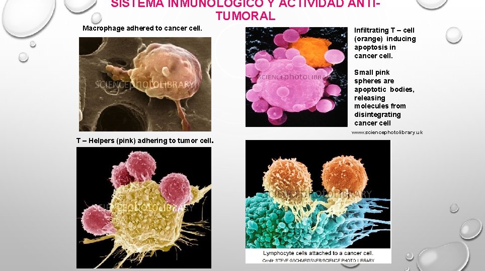 SISTEMA INMUNOLÓGICO Y ACTIVIDAD ANTITUMORAL Macrophage adhered to cancer cell. Infiltrating T – cell