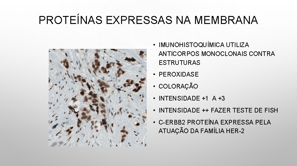 PROTEÍNAS EXPRESSAS NA MEMBRANA • IMUNOHISTOQUÍMICA UTILIZA ANTICORPOS MONOCLONAIS CONTRA ESTRUTURAS • PEROXIDASE •