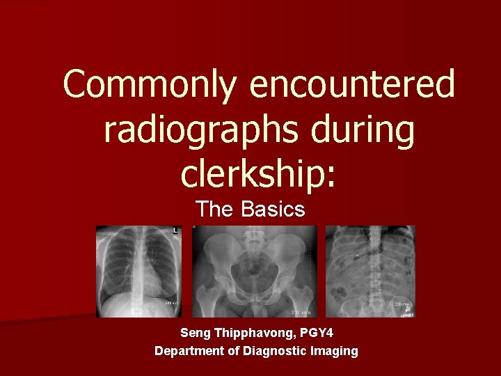 Commonly encountered radiographs during clerkship: The Basics Seng Thipphavong, PGY 4 Department of Diagnostic