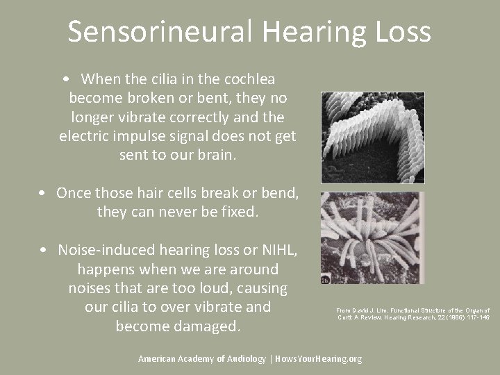 Sensorineural Hearing Loss • When the cilia in the cochlea become broken or bent, Sensorineural Hearing Loss • When the cilia in the cochlea become broken or bent,