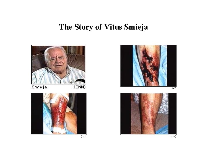 The Story of Vitus Smieja 