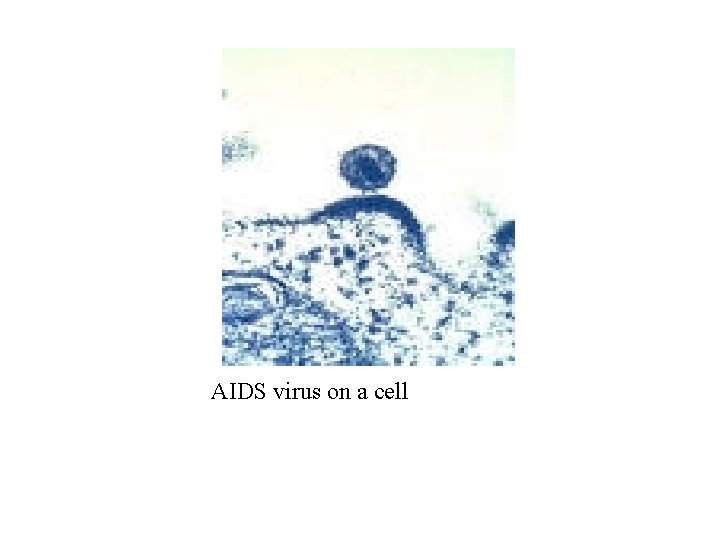 AIDS virus on a cell 