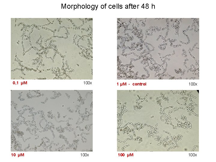 Morphology of cells after 48 h 0, 1 µM 100 x 1 µM -