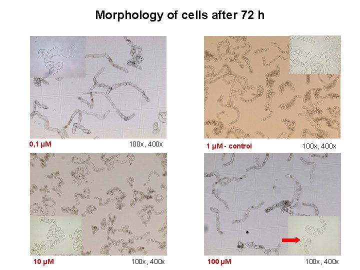 Morphology of cells after 72 h 0, 1 µM 100 x, 400 x 1
