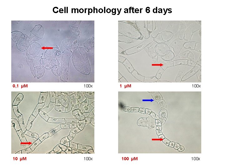 Cell morphology after 6 days 0, 1 µM 100 x 10 µM 100 x