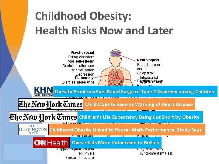 Childhood Obesity: Health Risks Now and Later Psychosocial Eating disorders Neurological Poor self-esteem Pseudotumour