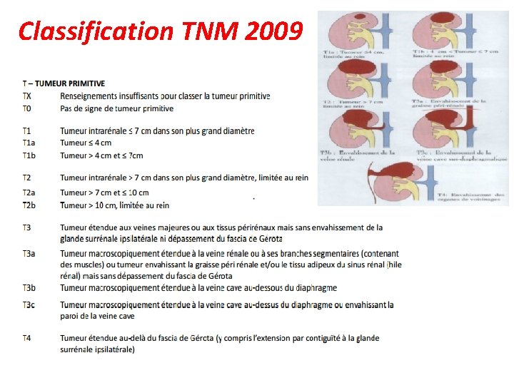 Classification TNM 2009 