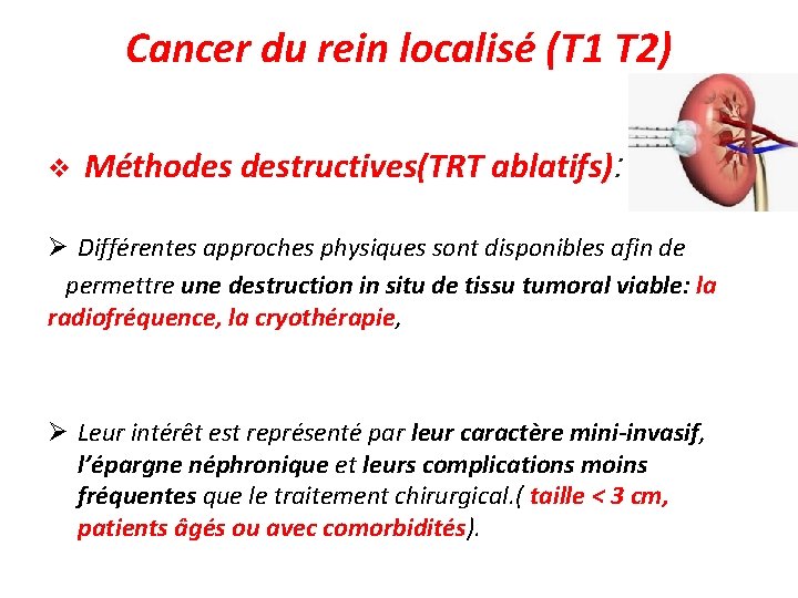 Cancer du rein localisé (T 1 T 2) v Méthodes destructives(TRT ablatifs): Différentes approches