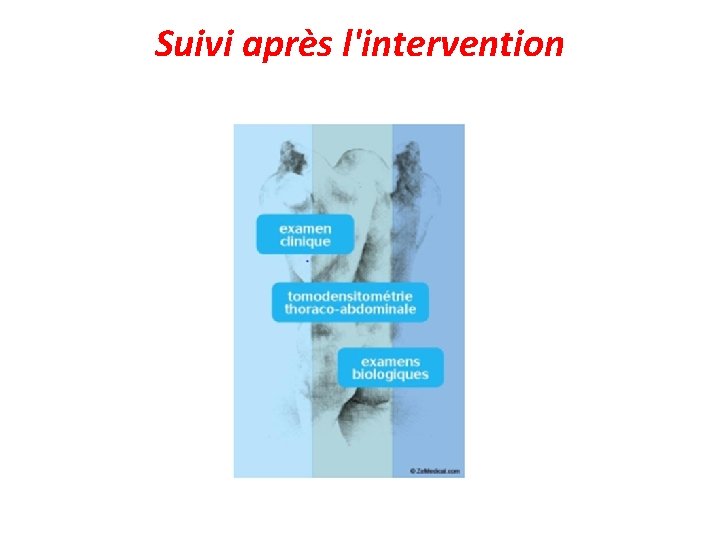 Suivi après l'intervention 