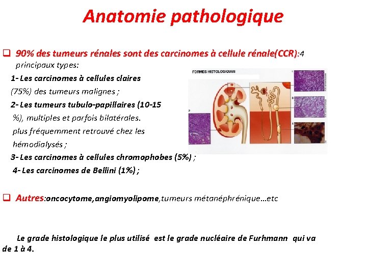 Anatomie pathologique q 90% des tumeurs rénales sont des carcinomes à cellule rénale(CCR): 4