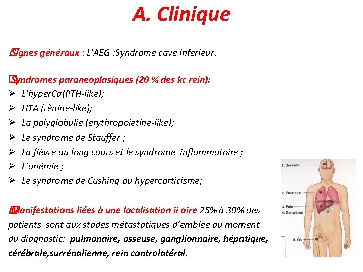 A. Clinique � Signes généraux : L’AEG : Syndrome cave inférieur. � Syndromes paraneoplasiques