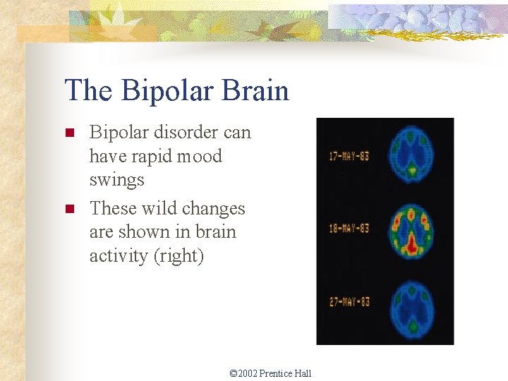 The Bipolar Brain n n Bipolar disorder can have rapid mood swings These wild