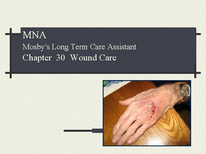 MNA Mosby’s Long Term Care Assistant Chapter 30 Wound Care 