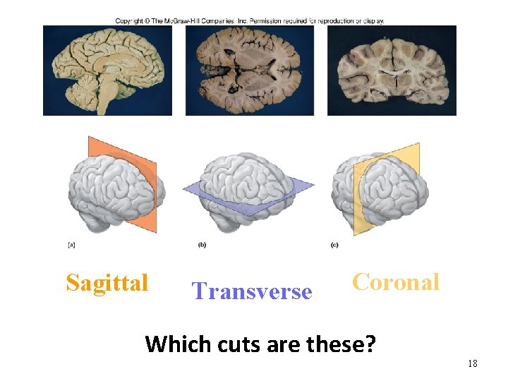 Sagittal Transverse Coronal Which cuts are these? 18 