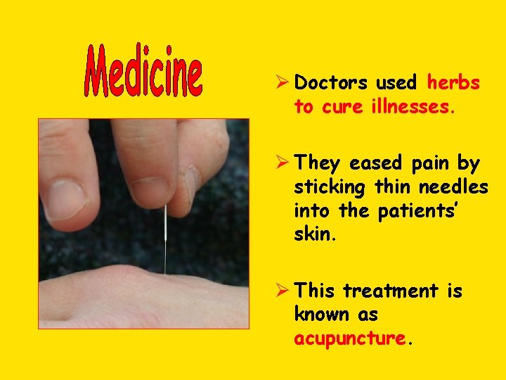 Ø Doctors used herbs to cure illnesses. Ø They eased pain by sticking thin