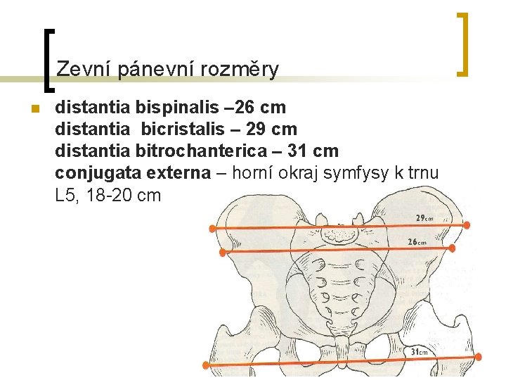 Zevní pánevní rozměry n distantia bispinalis – 26 cm distantia bicristalis – 29 cm