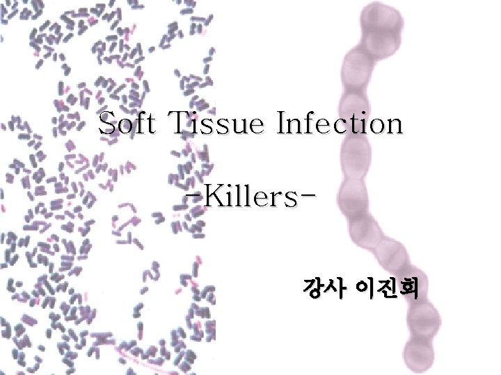 Soft Tissue Infection -Killers강사 이진희 
