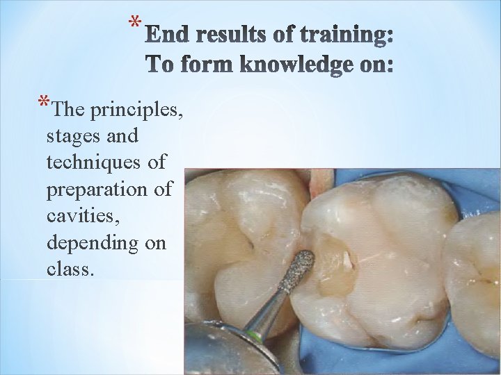 * *The principles, stages and techniques of preparation of cavities, depending on class. 