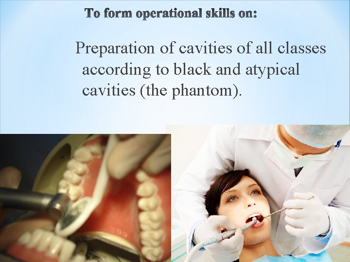 Preparation of cavities of all classes according to black and atypical cavities (the phantom).