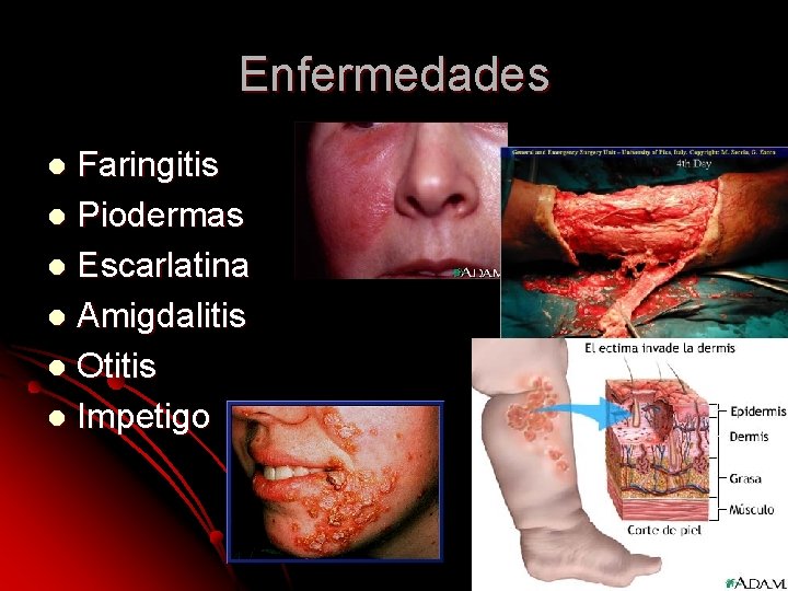 Enfermedades Faringitis l Piodermas l Escarlatina l Amigdalitis l Otitis l Impetigo l Enfermedades Faringitis l Piodermas l Escarlatina l Amigdalitis l Otitis l Impetigo l
