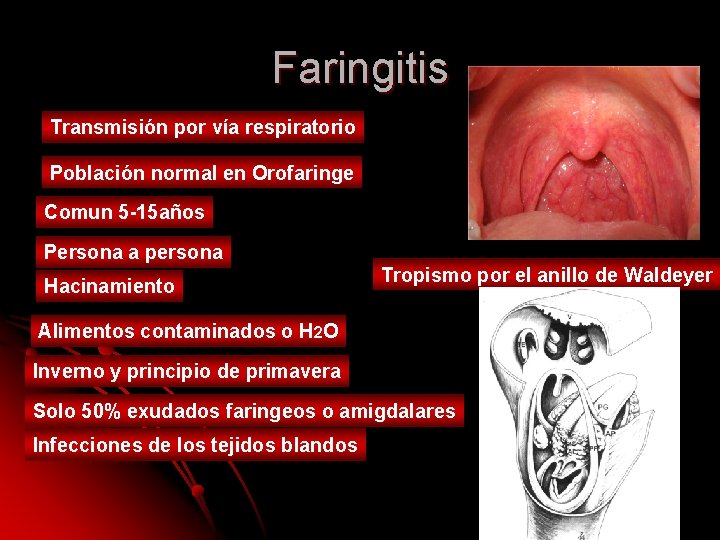 Faringitis Transmisión por vía respiratorio Población normal en Orofaringe Comun 5 -15 años Persona Faringitis Transmisión por vía respiratorio Población normal en Orofaringe Comun 5 -15 años Persona