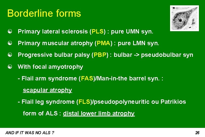 Borderline forms ☯ Primary lateral sclerosis (PLS) : pure UMN syn. ☯ Primary muscular