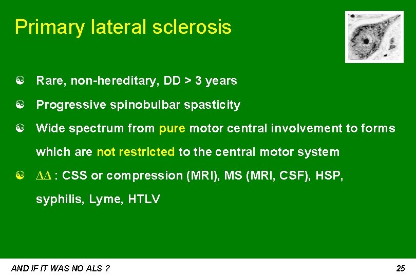 Primary lateral sclerosis ☯ Rare, non-hereditary, DD > 3 years ☯ Progressive spinobulbar spasticity