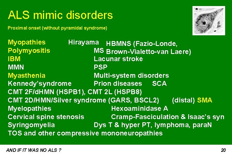 ALS mimic disorders Proximal onset (without pyramidal syndrome) Myopathies Hirayama HBMNS (Fazio-Londe, Polymyositis MS