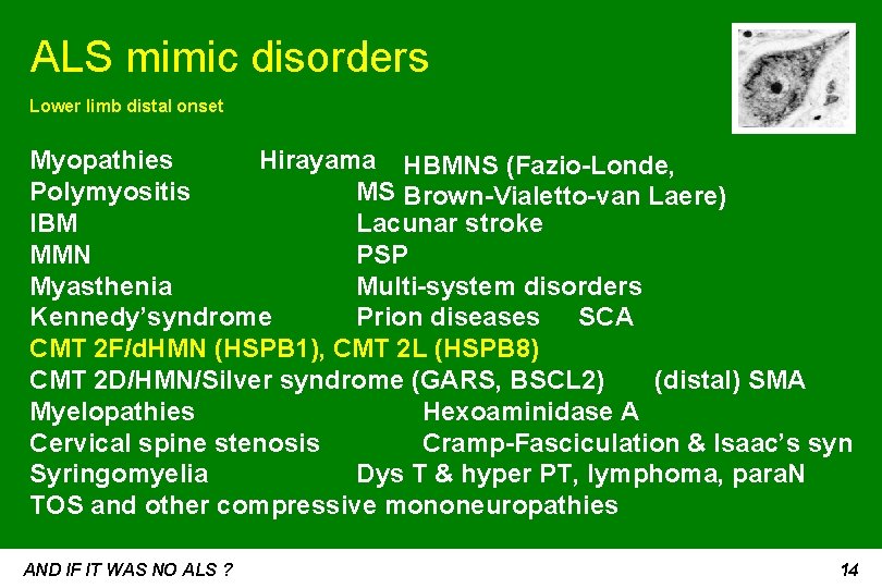ALS mimic disorders Lower limb distal onset Myopathies Hirayama HBMNS (Fazio-Londe, Polymyositis MS Brown-Vialetto-van