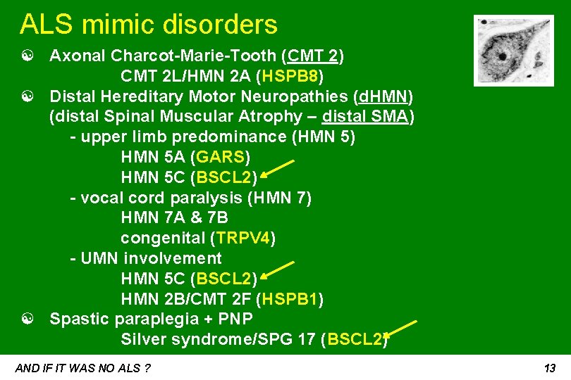 ALS mimic disorders ☯ Axonal Charcot-Marie-Tooth (CMT 2) CMT 2 L/HMN 2 A (HSPB