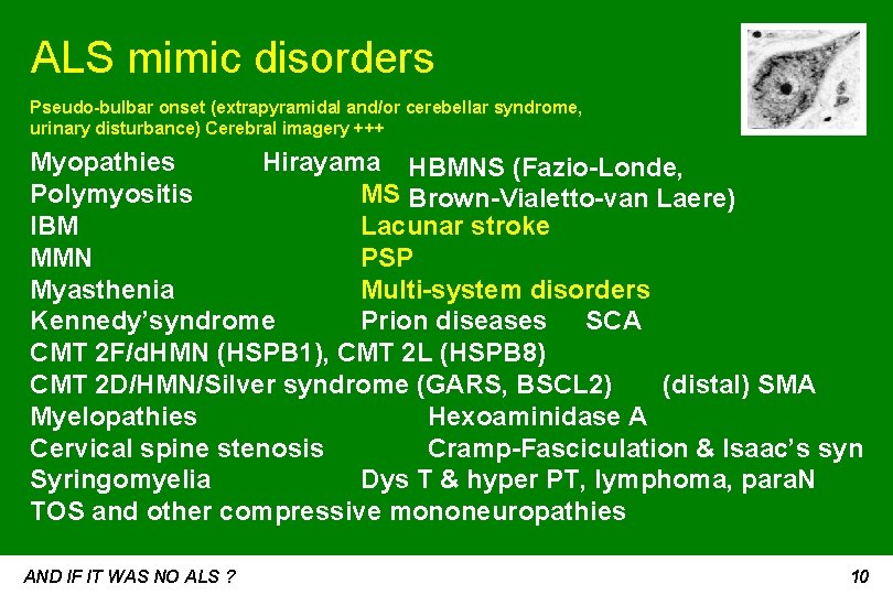 ALS mimic disorders Pseudo-bulbar onset (extrapyramidal and/or cerebellar syndrome, urinary disturbance) Cerebral imagery +++