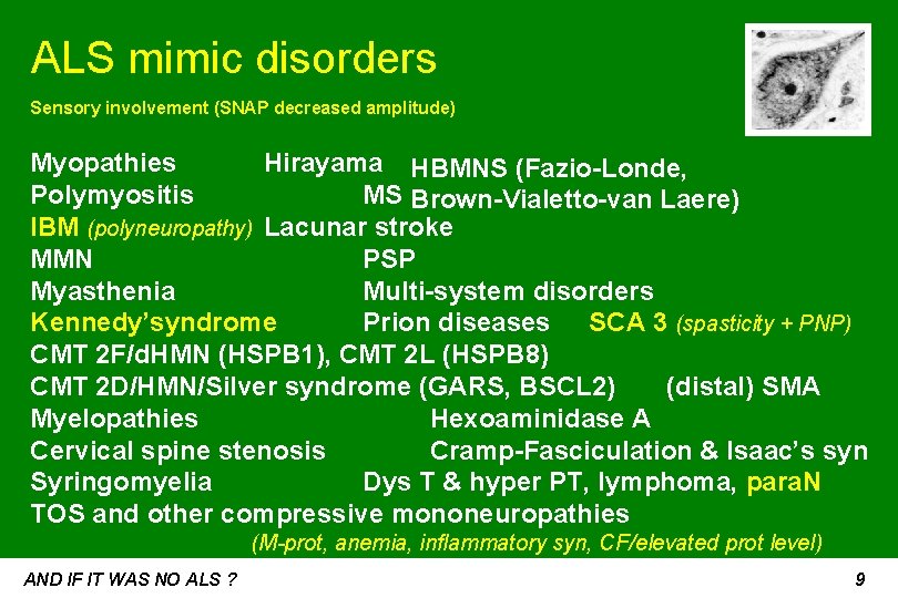 ALS mimic disorders Sensory involvement (SNAP decreased amplitude) Myopathies Hirayama HBMNS (Fazio-Londe, Polymyositis MS