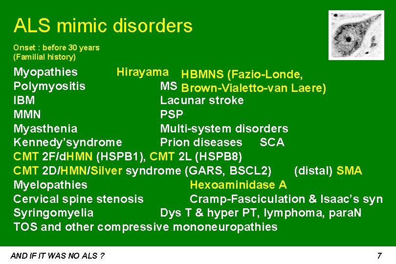 ALS mimic disorders Onset : before 30 years (Familial history) Myopathies Hirayama HBMNS (Fazio-Londe,