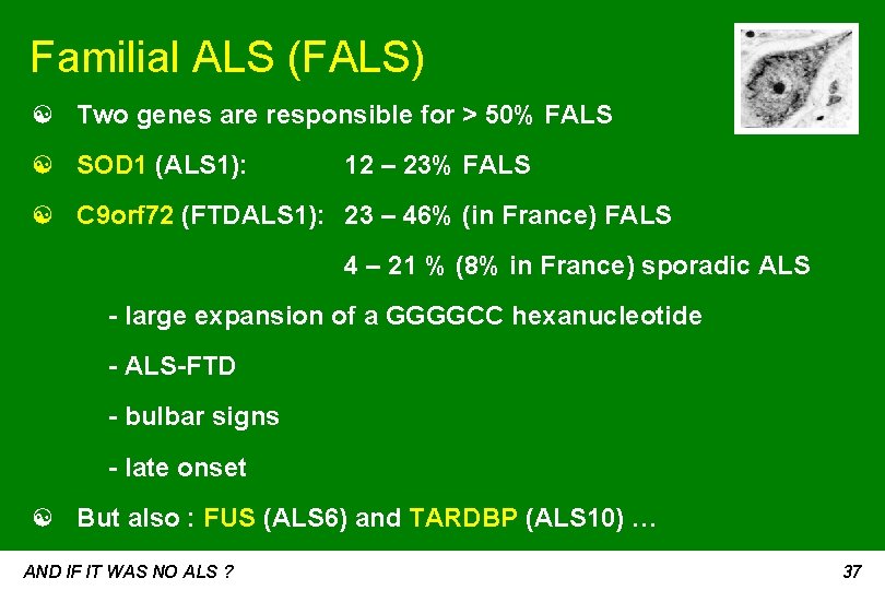Familial ALS (FALS) ☯ Two genes are responsible for > 50% FALS ☯ SOD