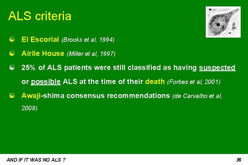 ALS criteria ☯ El Escorial (Brooks et al, 1994) ☯ Airlie House (Miller et