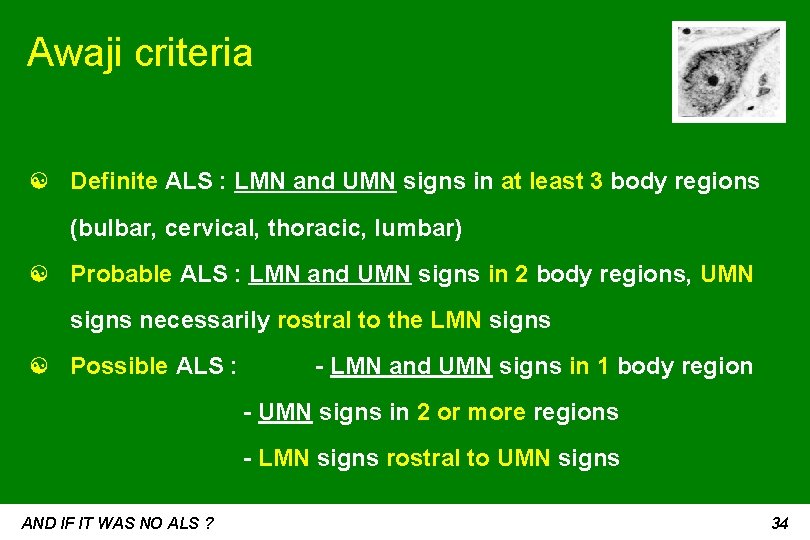 Awaji criteria ☯ Definite ALS : LMN and UMN signs in at least 3